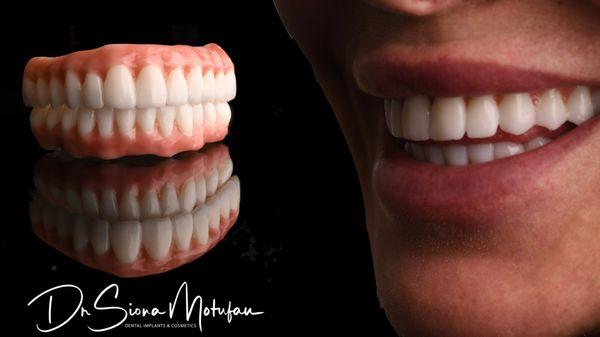 Ohana Dental Implant Centers - Clifton