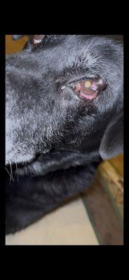 Her eye infection was very treated for!