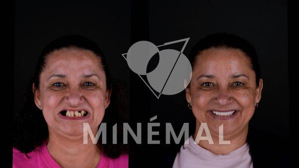 Minemal Dental