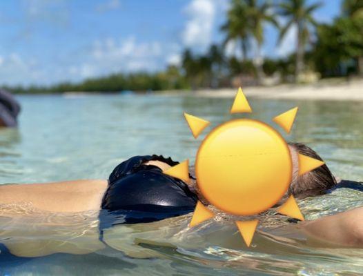 Natural looking implants