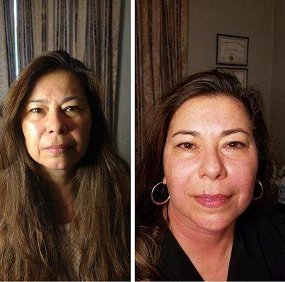 Skin Solutions and More