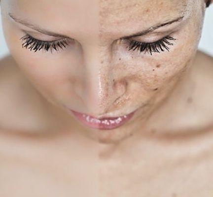 BIO - SKIN Med|Aesthetics