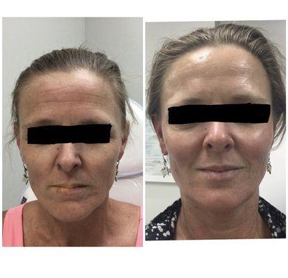 Fine Aesthetics and Laser Center