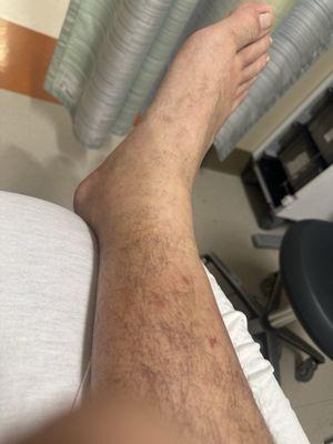 Park Nicollet Urgent Care - St. Louis Park