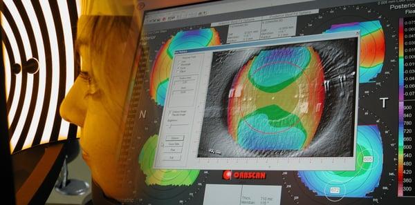 Orbscan Eye Technology