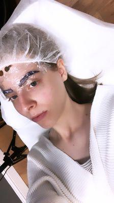 right before the procedure, after she put the numbing treatment on, with the pen drawn on where my eyebrows are going to be.