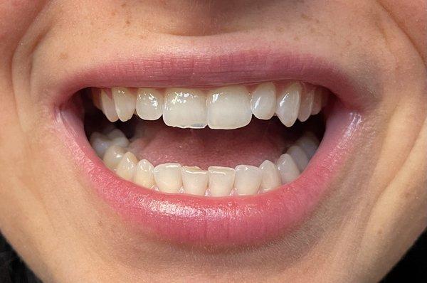 Smiley Dental of Beverly