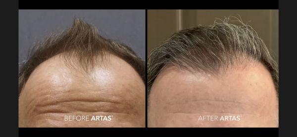 Fallon Hair Restoration