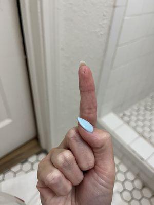 One of the small bugs crawling on us