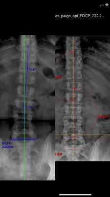 Restructured Chiropractic