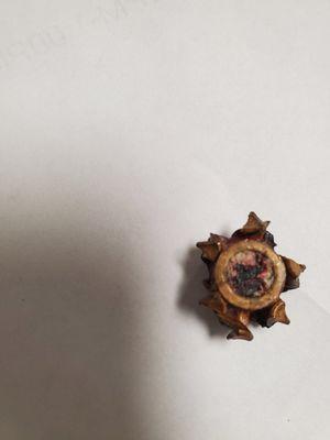 This is one of the 40 caliber bullets that went in my spine