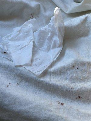 Blood from my dogs paws after being groomed