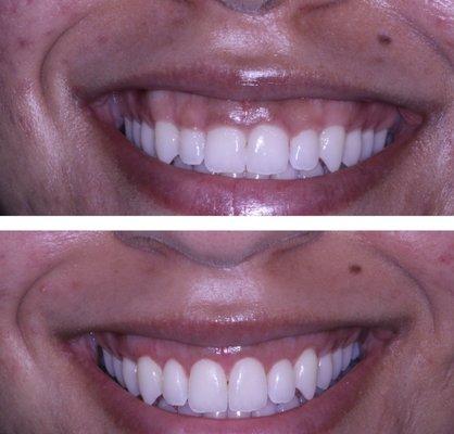 Precision Periodontics and Implant Dentistry