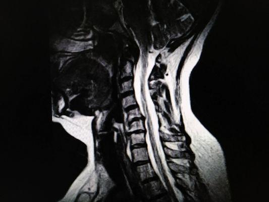 MRI of America