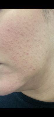 California Skin Institute - Sunnyvale