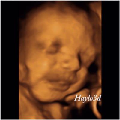 Haylo 3D Imaging