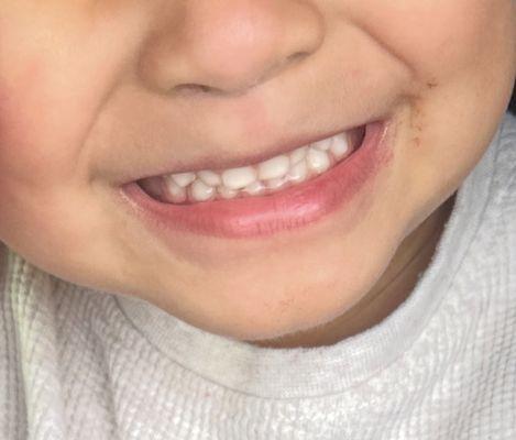 Before being attended by Dr Jyoti
Sharma. 1 of out 3