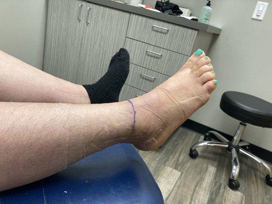 Foot & Ankle Clinics of Arizona