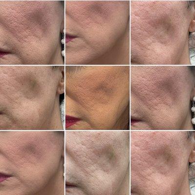 Highly Artistic Surgery