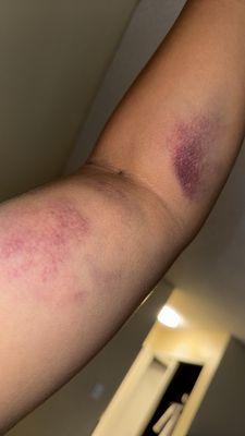 BioLife Plasma Services