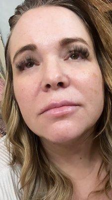 7 hours after application. more than half the lashes gone and my eyes are on fire