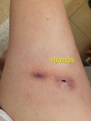 Sidney Smith - Georgia Skin and Cancer