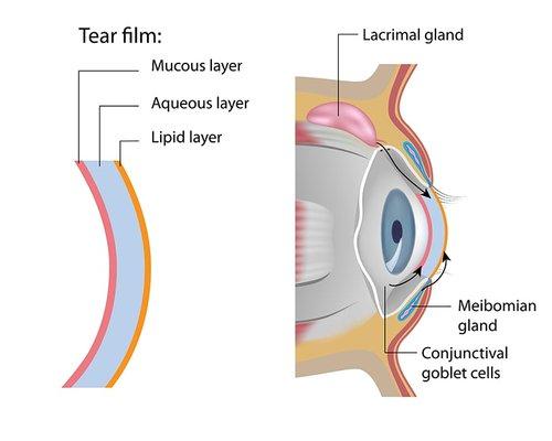 The Lipid Layer in the layer produced by the Meibomian Glands... those are the ones we rescue.