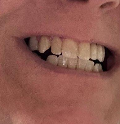 Frazee Family Dentistry