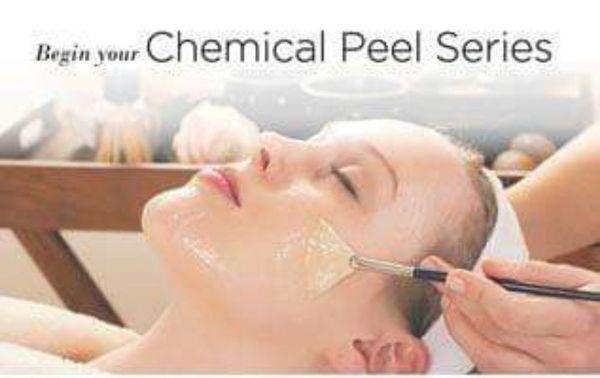 VARIETY OF CHEMICAL PEELS