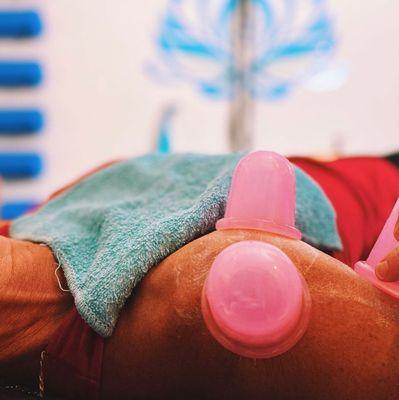 Cupping is a great way to release tension in joints