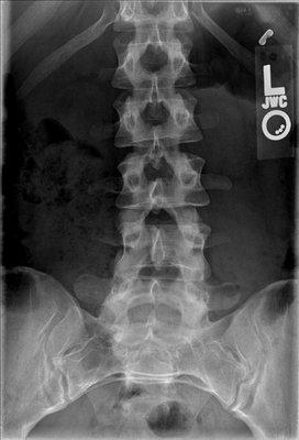 Willits Chiropractic Clinic