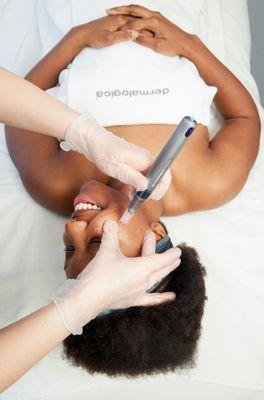 Luminfusion, Chemical Peels & a Variety of facials for all skin types