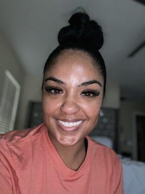 My lashes 5 days after a fill!