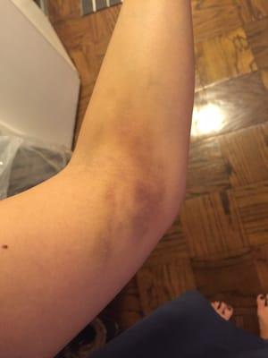 7 days after getting my blood drawn