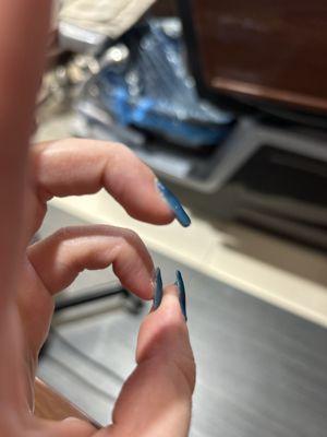 Nail popping off already