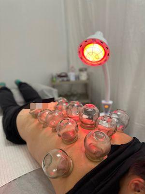 Long Island Wellness Acupuncture