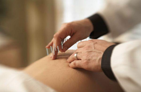 Jim Bloomfield, L Ac