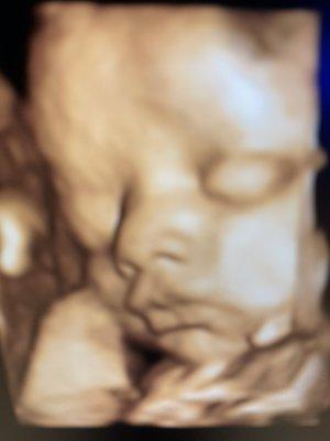 Baby Envision Grand Rapids