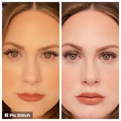 Revive Med Spa - Mission Valley