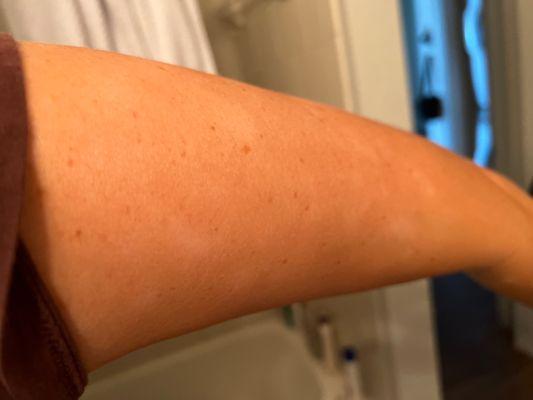 White spots with an orange tan, awesome...