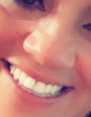 Taunton Dental Associates