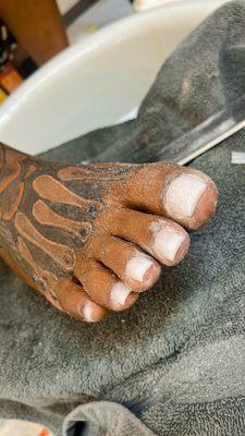 No Blemish Beauty Bar