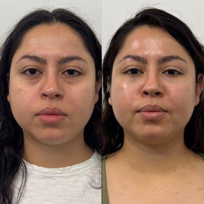 Lifted Aesthetics Charlotte