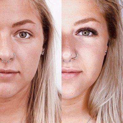 Before and after of volume full set