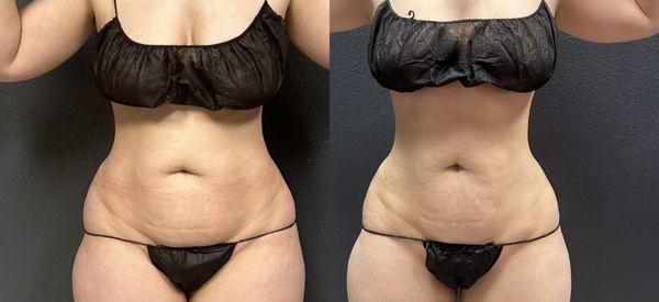 Grace MedSpa & Body Solutions