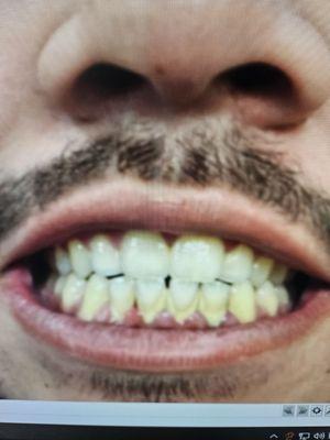 Years without a cleaning or a visit to a dentist