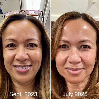 Comparison 2023 to 2025 with Erin