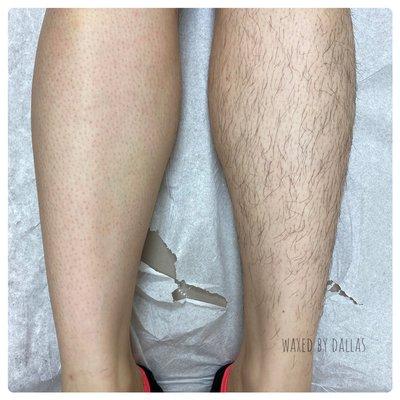 Leg wax!