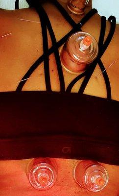 Spine and Disc Center