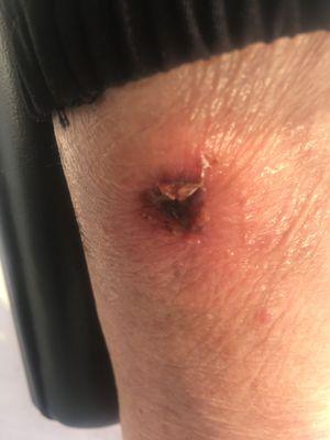 The Villas At Green Valley